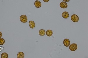 U. pencanus spores 40x