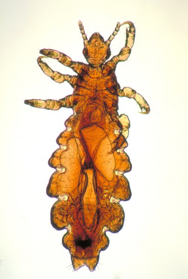 Head louse [Pediculus humanus capitis]